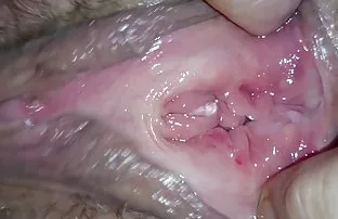 ağrılı bir cinsiyetin bir seansta herhangi sexk video izle bir hastalığı iyileştirebileceği